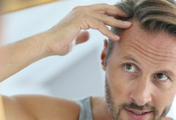 What Is Scalp Micropigmentation For Hair Loss